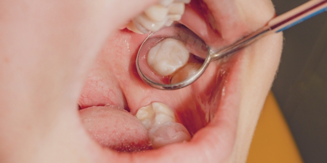 Dentística Restauradora clinica odontologia em paraíso sp