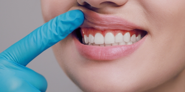Periodontia clinica odontologia em paraíso sp