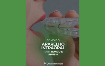 Aparelho Intraoral para Ronco e Apneia do Sono em São Paulo