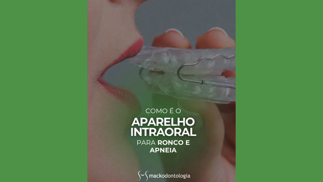 Aparelho Intraoral para Ronco e Apneia do Sono em São Paulo
