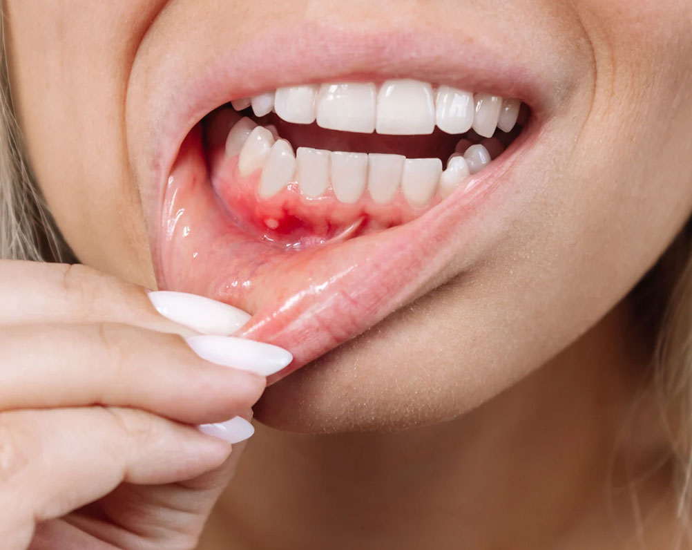 Periodontia no centro de São Paulo Periodontia no centro de São Paulo