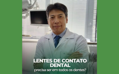 Lentes de Contato Dental: é preciso colocar em todos os dentes?