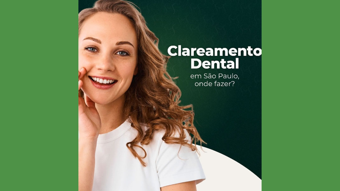Clareamento Dental em São Paulo, onde Fazer?