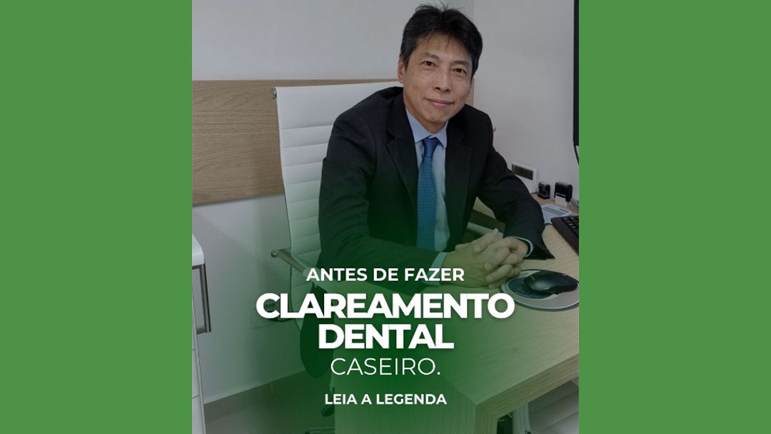 Clareamento Dental Caseiro em São Paulo – Paraíso