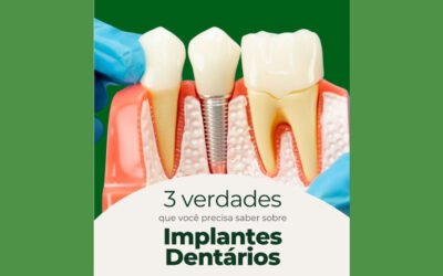 Três verdades sobre implantes dentários que você precisa saber