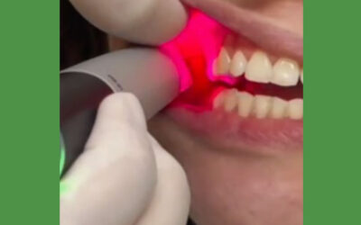 Como é feito o escaneamento intraoral nos dentes?