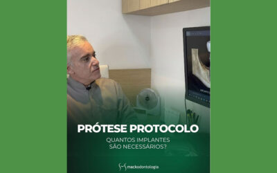 Prótese protocolo: o que é, quantos implantes são necessários e quando é indicada