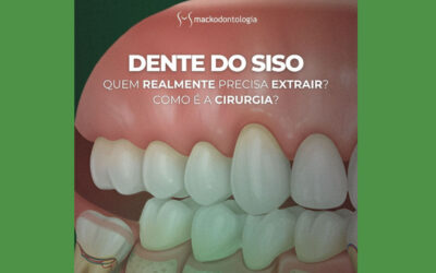 Dente do siso: quem realmente precisa extrair? Como é a cirurgia?