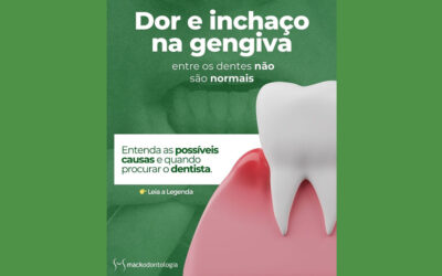 Gengiva inchada e dolorida entre os dentes