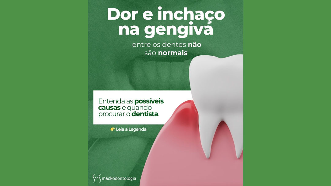 Gengiva inchada e dolorida no Paraíso SP