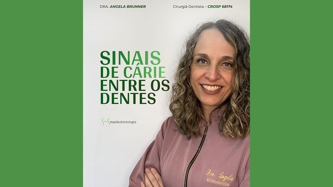 Cárie entre os dentes no Paraíso em São Paulo